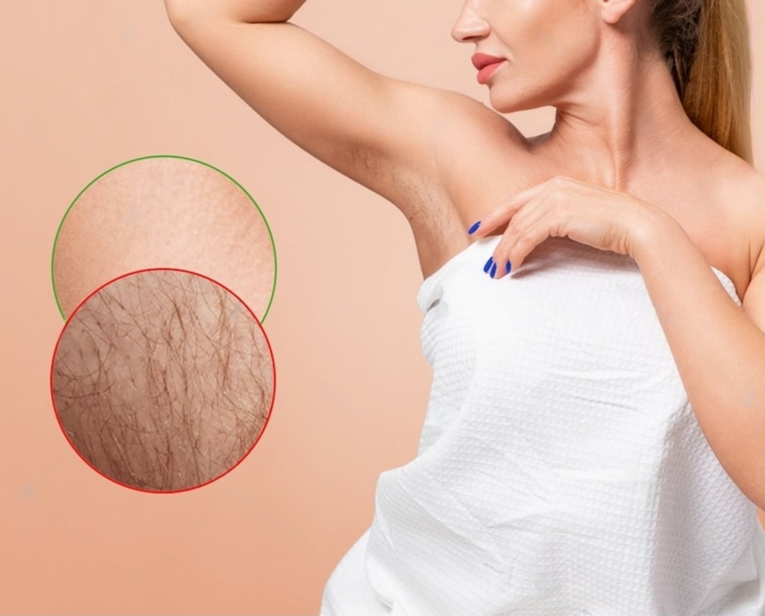 hair removal zuerich eingangsbereich 3 768x512 9